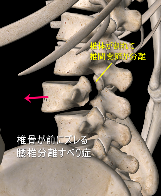 a25feea9e920df544eed0580167ba43d-640x780.png